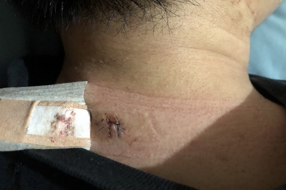 【有影】飛來橫禍 男大生提告遭不識醉漢酒瓶爆頭 70 a02 2