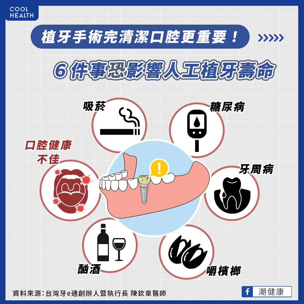 植牙完清潔更重要? 如何挑選植牙醫師? 植牙完清潔更重要? 如何挑選植牙醫師?
