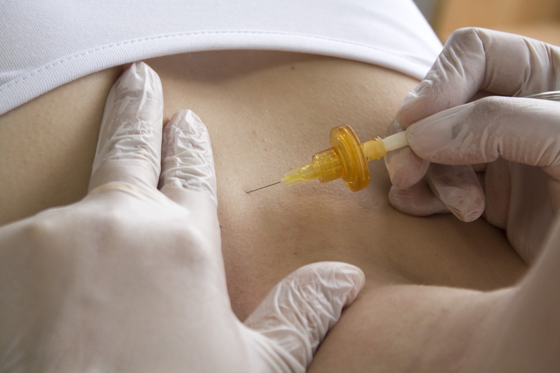 carbon-dioxide-therapy-5432591_1920