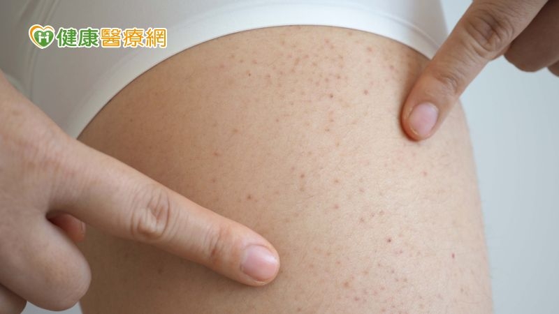 空姐罹病嚴重出血 再生不良性貧血如何覓得生機?