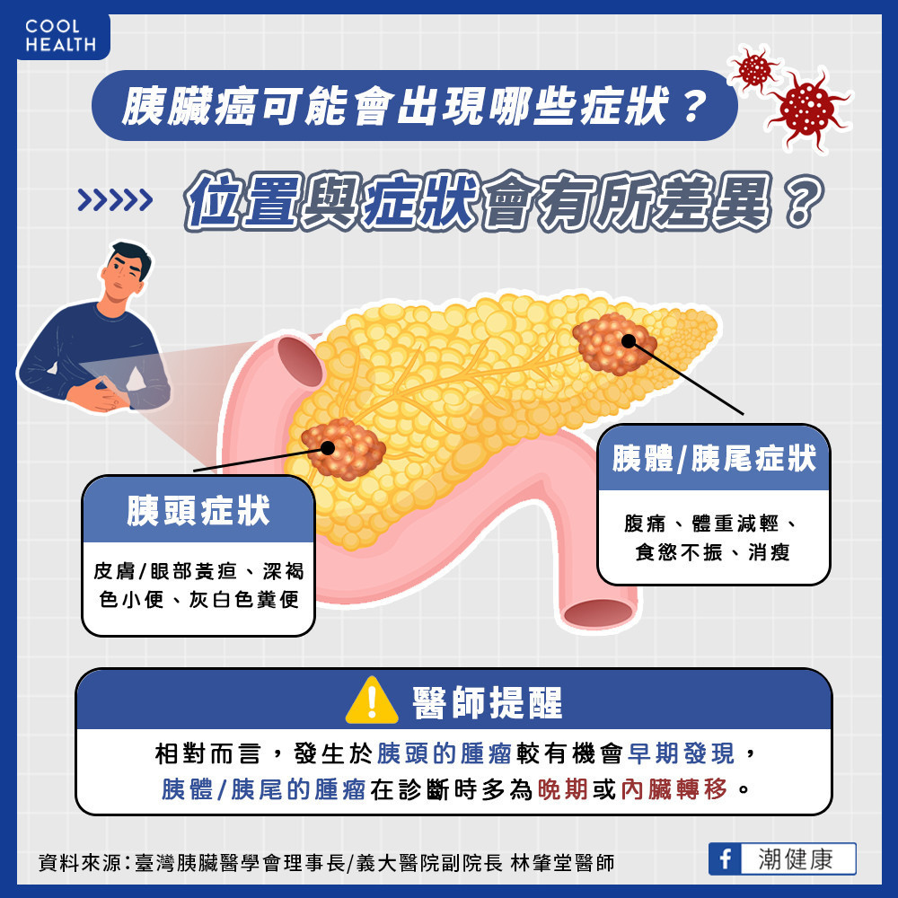 胰臟癌可能有哪些症狀? 位置與症狀有所差異? 胰臟癌可能有哪些症狀? 位置與症狀有所差異?
