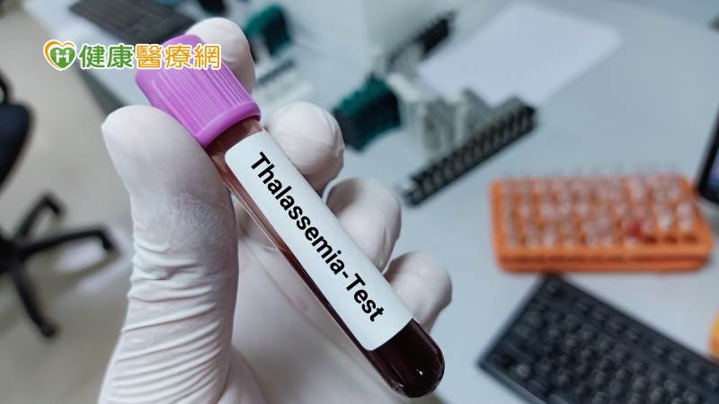 「地中海貧血」檢查很重要！　如何檢測？帶因者該怎麼辦？專家解答