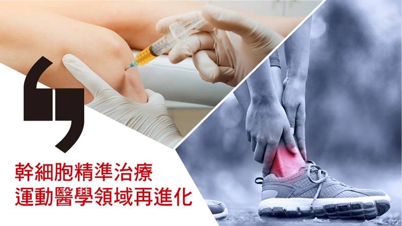 幹細胞精準治療 運動醫學領域再進化