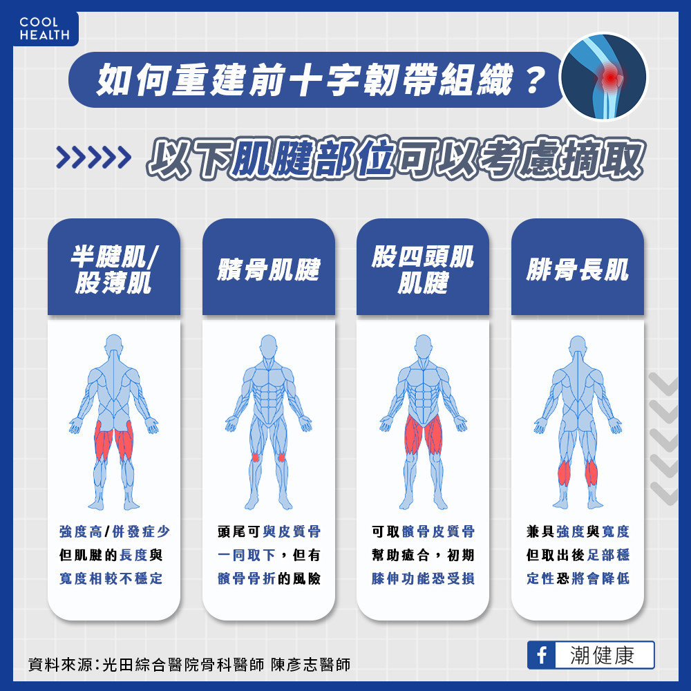如何重建前十字韌帶組織? 哪些肌腱部位可以考慮摘取? 如何重建前十字韌帶組織? 哪些肌腱部位可以考慮摘取?
