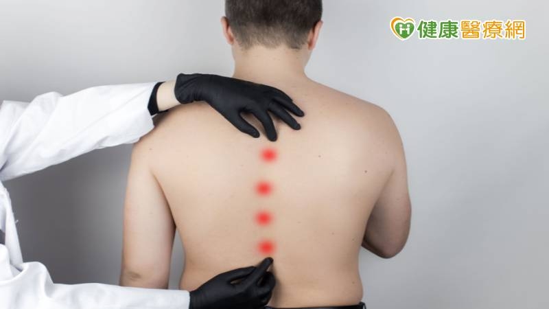 僵直性脊椎炎致難呼吸、走路不便 一次性矯正大角度切骨助抬頭挺胸