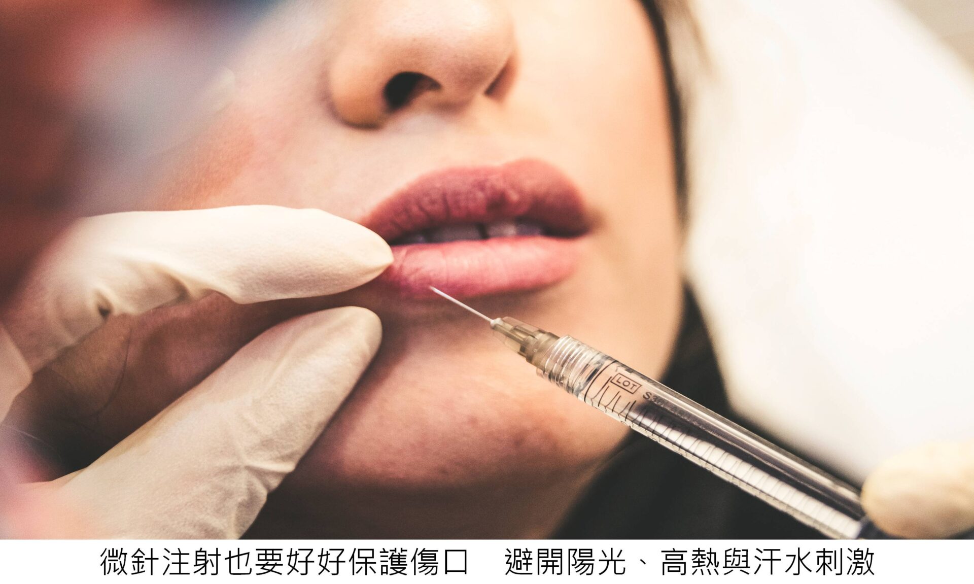 微針注射也要好好保護傷口 避開陽光、高熱與汗水刺激