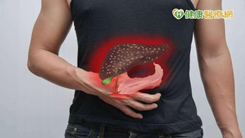 別放棄!大腸癌第四期肝轉 三管齊下治療仍有高存活率