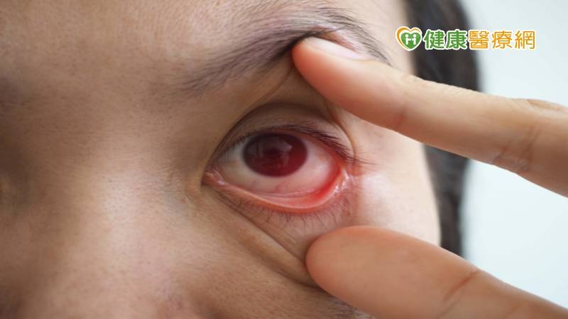 視網膜發病無感,發現已太晚! 國內研究證實:這中草可用於治療、預防