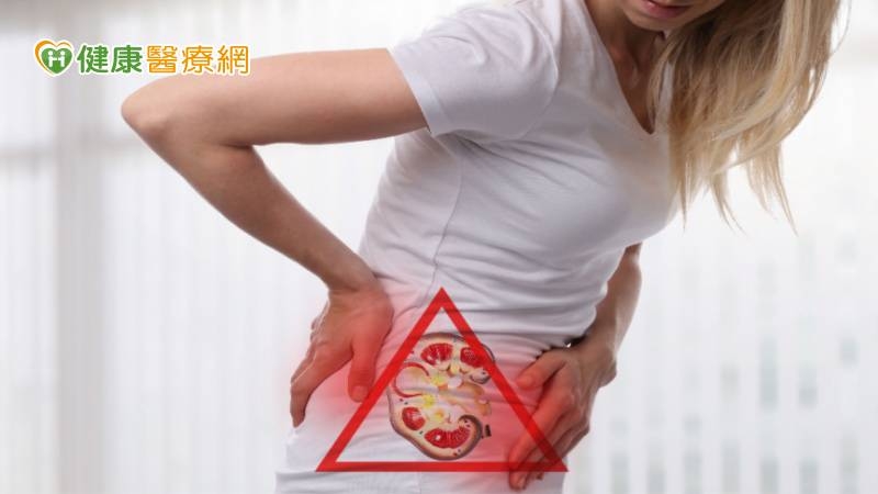 婦人腎結石又尿路狹窄取石超困難! 「新工具」一舉兩得助攻