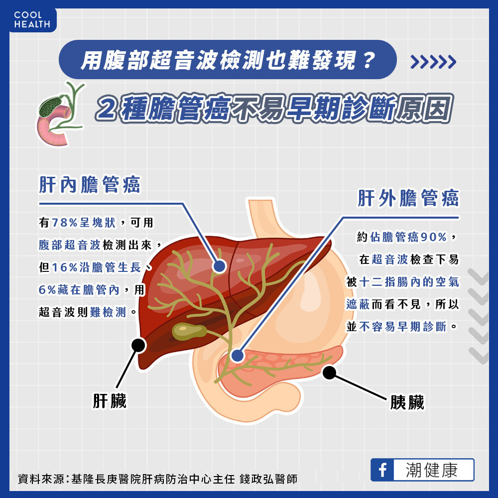 超音波也難發現? 醫揭膽管癌不易早期診斷原因 超音波也難發現? 醫揭膽管癌不易早期診斷原因