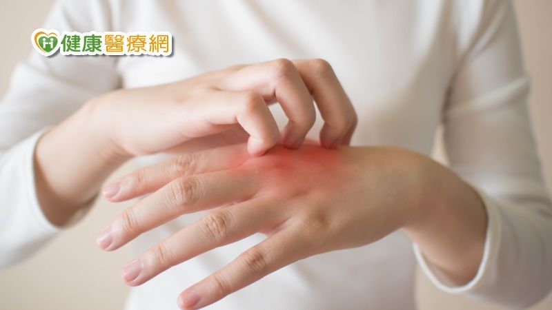 治療新知!棘手「結節性癢疹」不再沒藥醫 FDA核准第1個治療藥