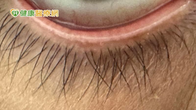 你知道睫毛需要清潔嗎？