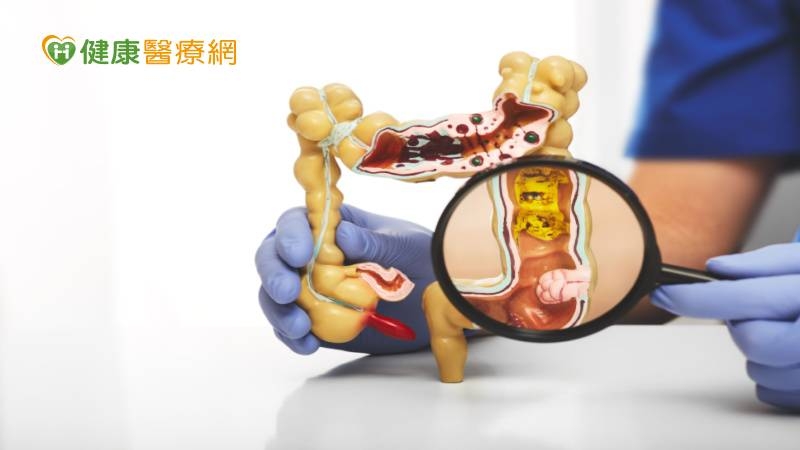 他一周沒「大號」腹痛就醫 檢查驚見「腸腫瘤」堵住通道