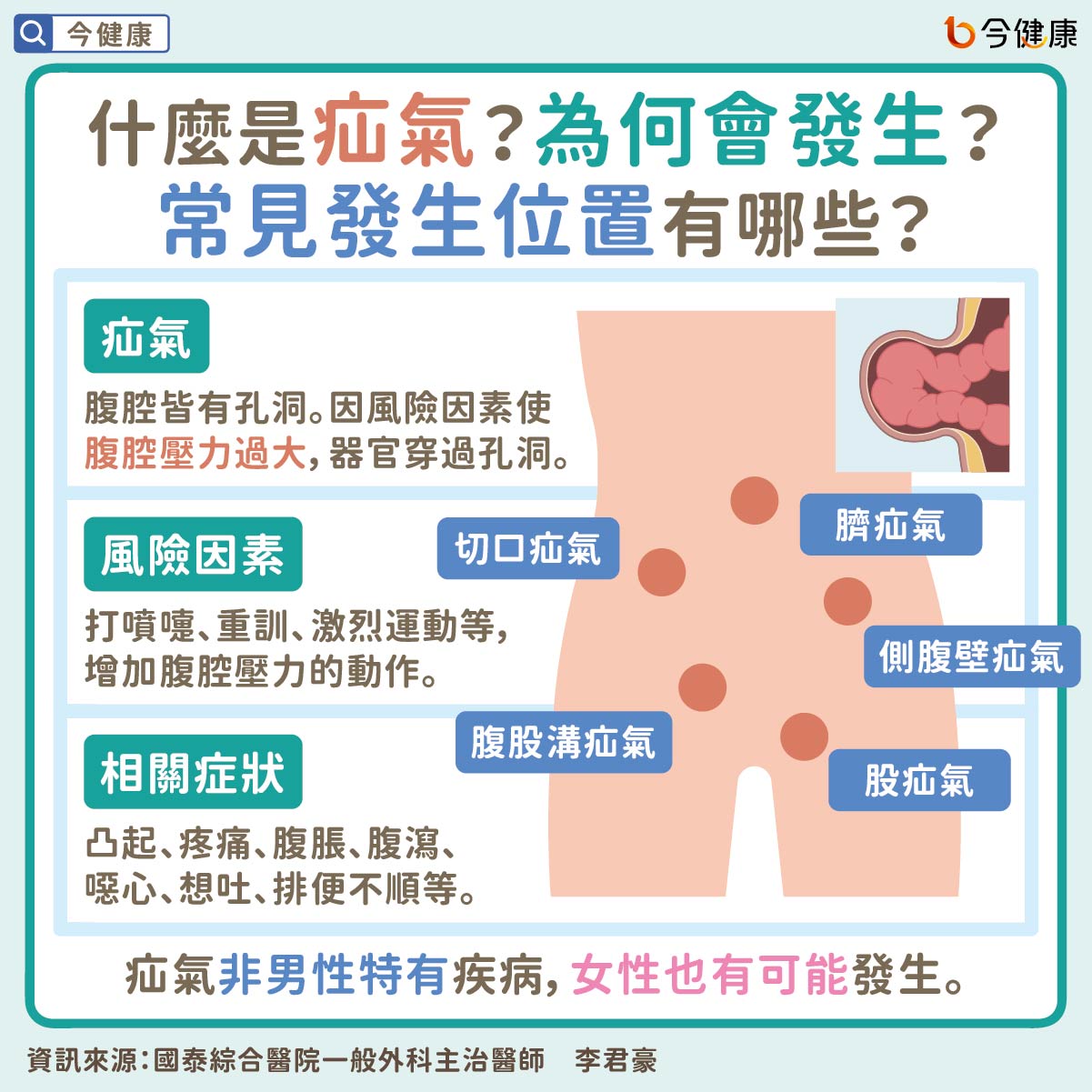 #李君豪 #疝氣 #腹痛 #腹脹