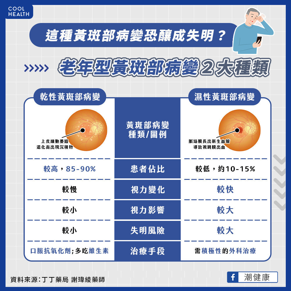 黃斑部病變分為乾性、濕性?造成視力影響不同? 黃斑部病變分為乾性、濕性?造成視力影響不同?