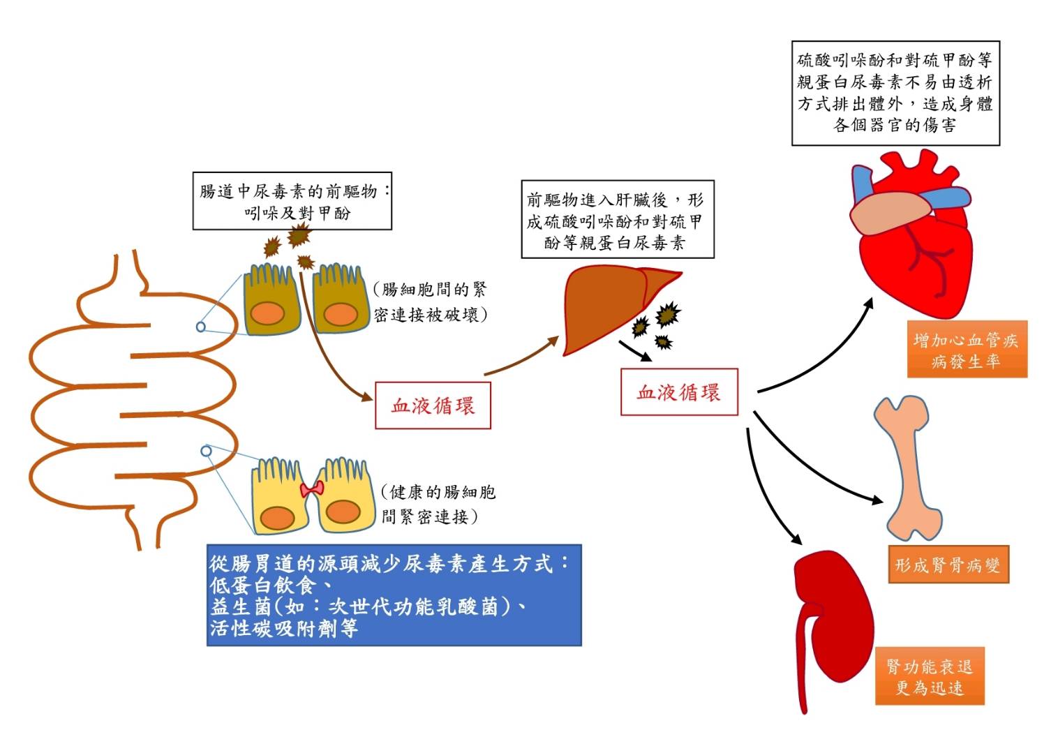 掌握好「腎」算!精準醫學延緩腎臟病進程 成未來治療新趨勢 208 匯流新聞網CNEWS資料照195230603a03