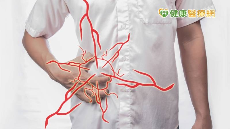 「疝氣」修補好又再發! 新型單孔術降低疼痛、提升安全性
