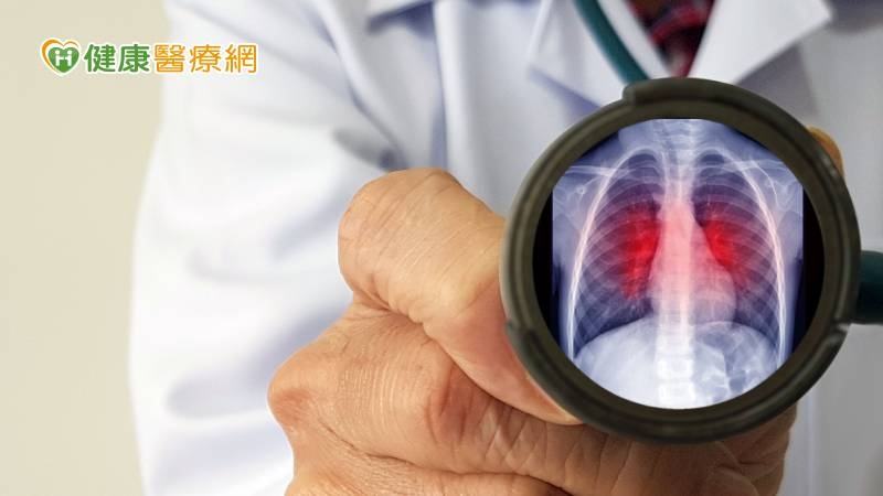 小心肺癌會遺傳! 醫籲「1動作」降低死亡風險:早期存活率達9成