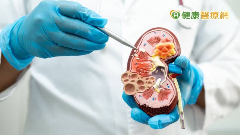 老翁「喝1中藥茶」退火 竟致腎功能惡化急洗腎