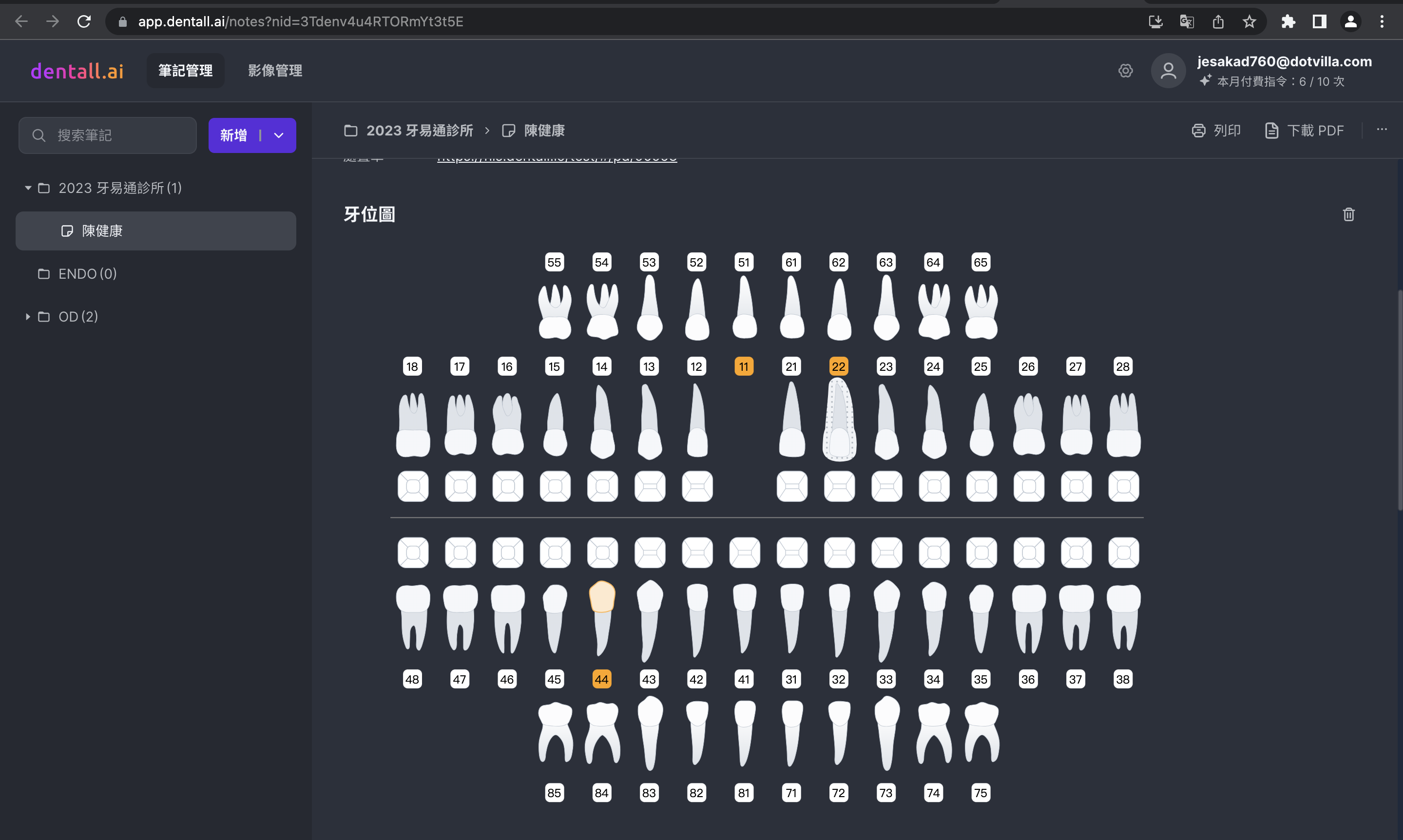 新聞照片03_ 透過 dentall.ai 彈指間就將病歷文字或語音,轉化為精美又直觀的牙位圖