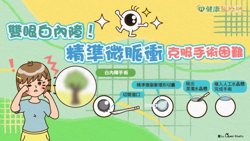 30多歲竟雙眼白內障! 宜蘭陽大附醫引進「精準微脈衝」嘉惠宜蘭鄉親