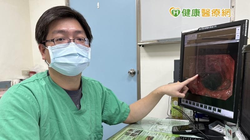 反覆腹瀉加上血便小心是「潰瘍性結腸炎」! 醫1招揪病灶