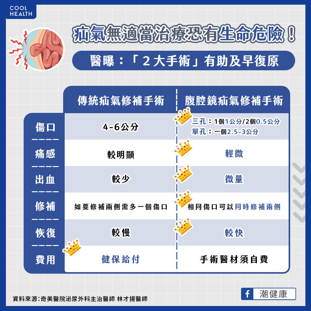 疝氣不治療恐會危及性命? 醫曝「1手術」減少疼痛加速痊癒 疝氣不治療恐會危及性命? 醫曝「1手術」減少疼痛加速痊癒