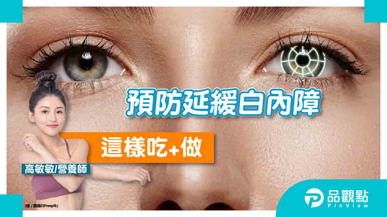 白內障病患年齡層下降,這樣吃+做延緩白內障病變發生