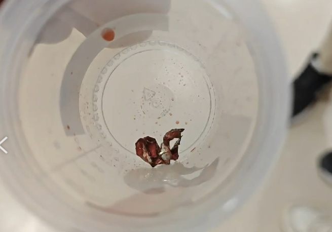 嘉義遶境氣爆案!13歲少年「全身45處穿刺傷」鐵片刺進胃部、脾臟 69 1689494562714 | 社會 社會 記者爆料網