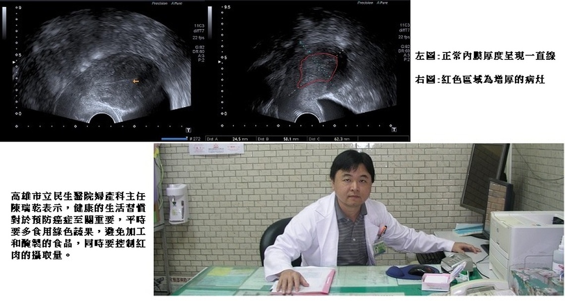 停經後不正常出血  可能是這個病