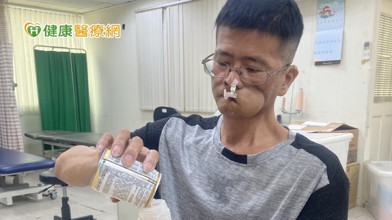 每小時1人罹口腔癌 癌父「手術取腿肉補臉」陷經濟困境