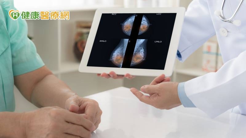 BRCA提前把關罹癌風險 精準醫療乳癌新利器