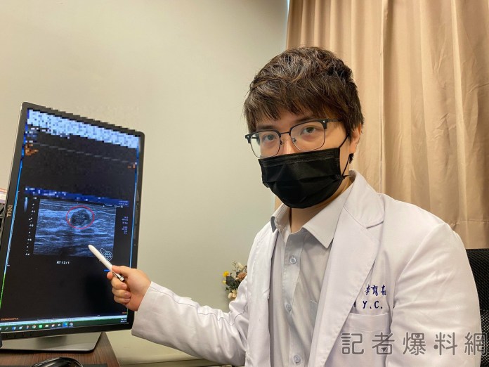不規則乳房纖維瘤罹癌風險高 醫:避免惡化建議切除 81 20230731 scaled | 健康 記者爆料網