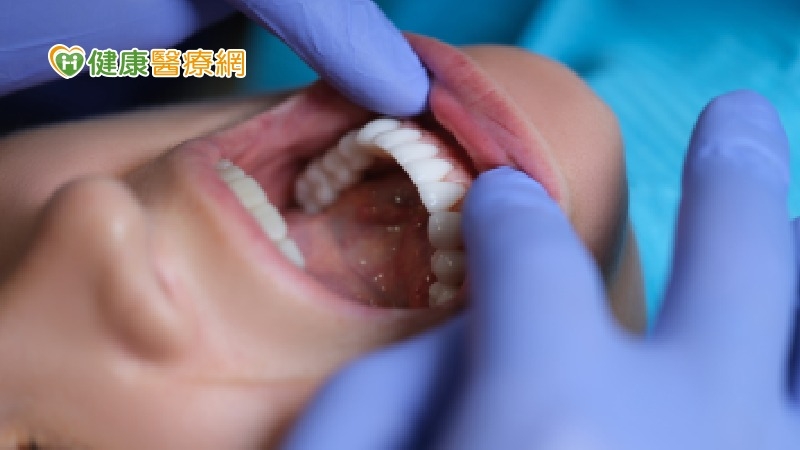 每年逾8千人罹口腔癌!影響「這些」重要功能 把握3原則遠離威脅