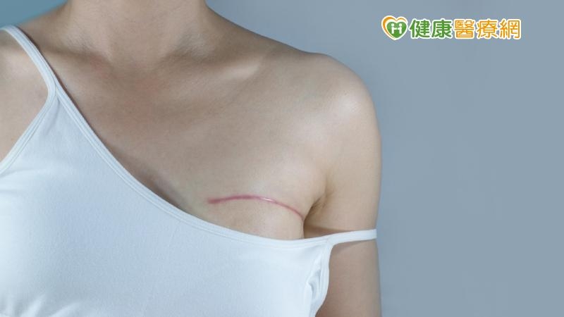 沒有乳房重建,乳癌治療只做了一半