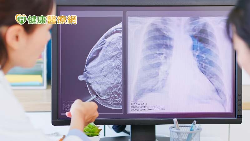 (國泰)確診乳癌後該怎麼辦? 透過實際案例了解乳癌診斷、治療、追蹤過程!