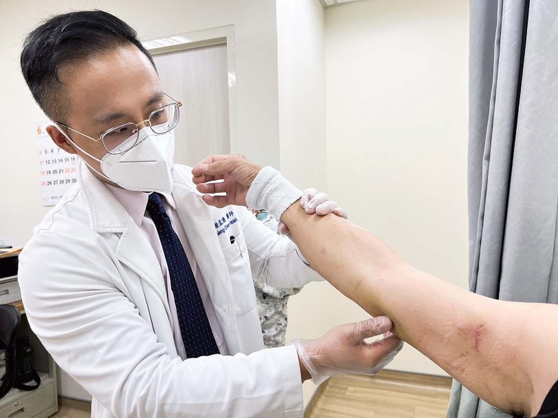 工人遭60公分鋼筋貫穿手臂 大同整外醫手術移除鋼筋恢復良好