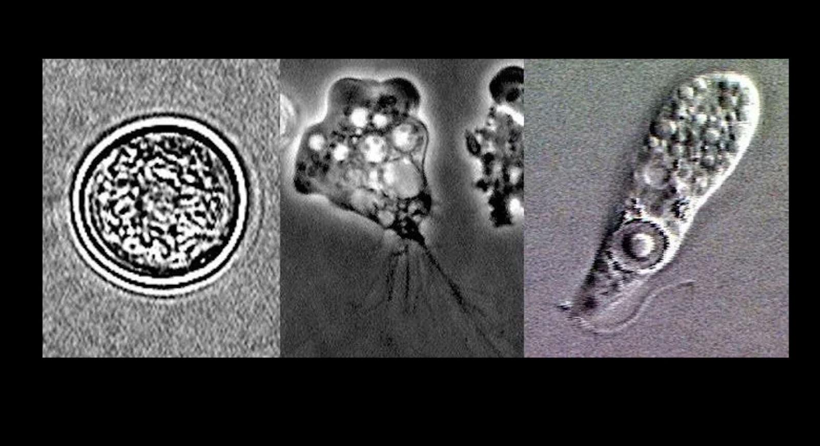 隔12年台灣又爆「食腦變形蟲」奪命! 30歲女室內玩水後發病、7天亡 264 隔12年台灣又爆「食腦變形蟲」奪命! 30歲女室內玩水後發病、7天亡 263