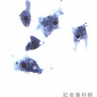相隔12年再現「食腦變形蟲」新北女玩水感染1週亡 衛生局:業者預防性停業 86 Naegleria trophA | 健康 記者爆料網