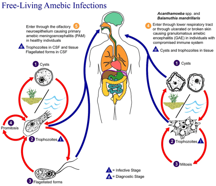 懶人包/食腦變形蟲入侵不到2周喪命 死亡率竟達95%超可怕 69 Free living amebic infections | 生活 生活 記者爆料網
