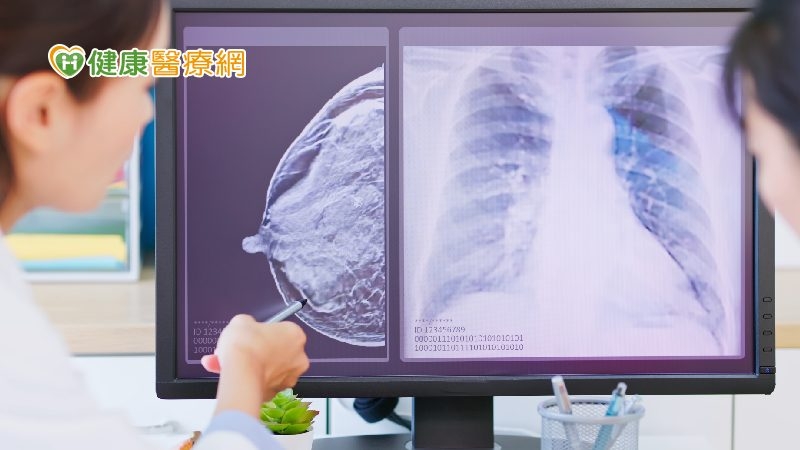 (國泰)乳癌術後將面臨哪些身體狀況? 了解術後飲食、運動、管路、傷口照護!