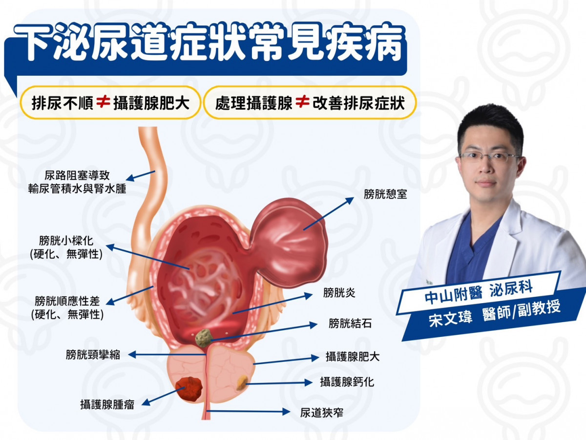 下泌尿道症狀常見疾病 。（圖／宋文瑋醫師團隊繪製與提供）