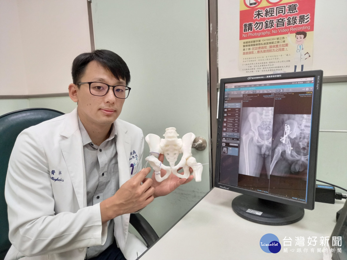嘉基醫院骨科姚樹鑫醫師以3D模組找出關節最佳轉活動角度／嘉基醫院提供