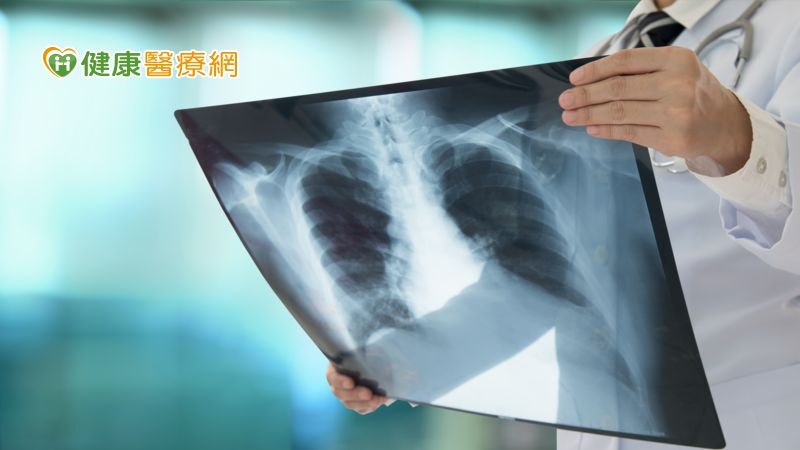 肺癌手術後要注意什麼?如何避免復發? 醫師來解答!