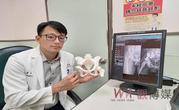 髖關節保存手術 免換人工關節疼痛症狀獲改善