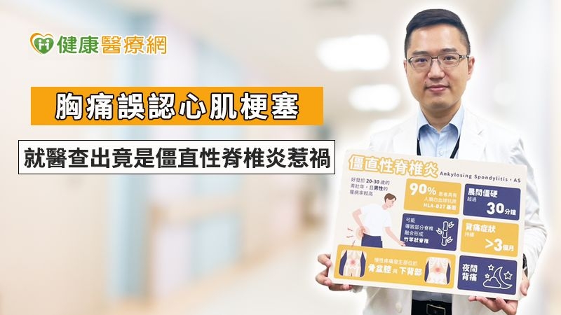 胸痛誤認心肌梗塞 就醫查出竟是僵直性脊椎炎惹禍!