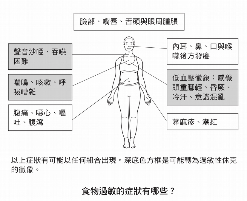哪些食物會造成食物過敏?