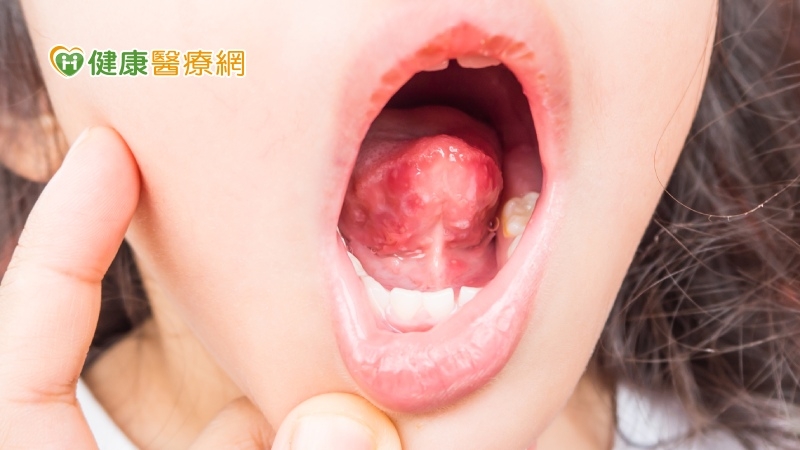 今年首例腸病毒奪命! 醫囑9月開學「免疫討債」攀高峰