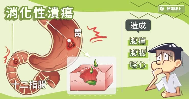 上腹痛就是胃不好嗎?