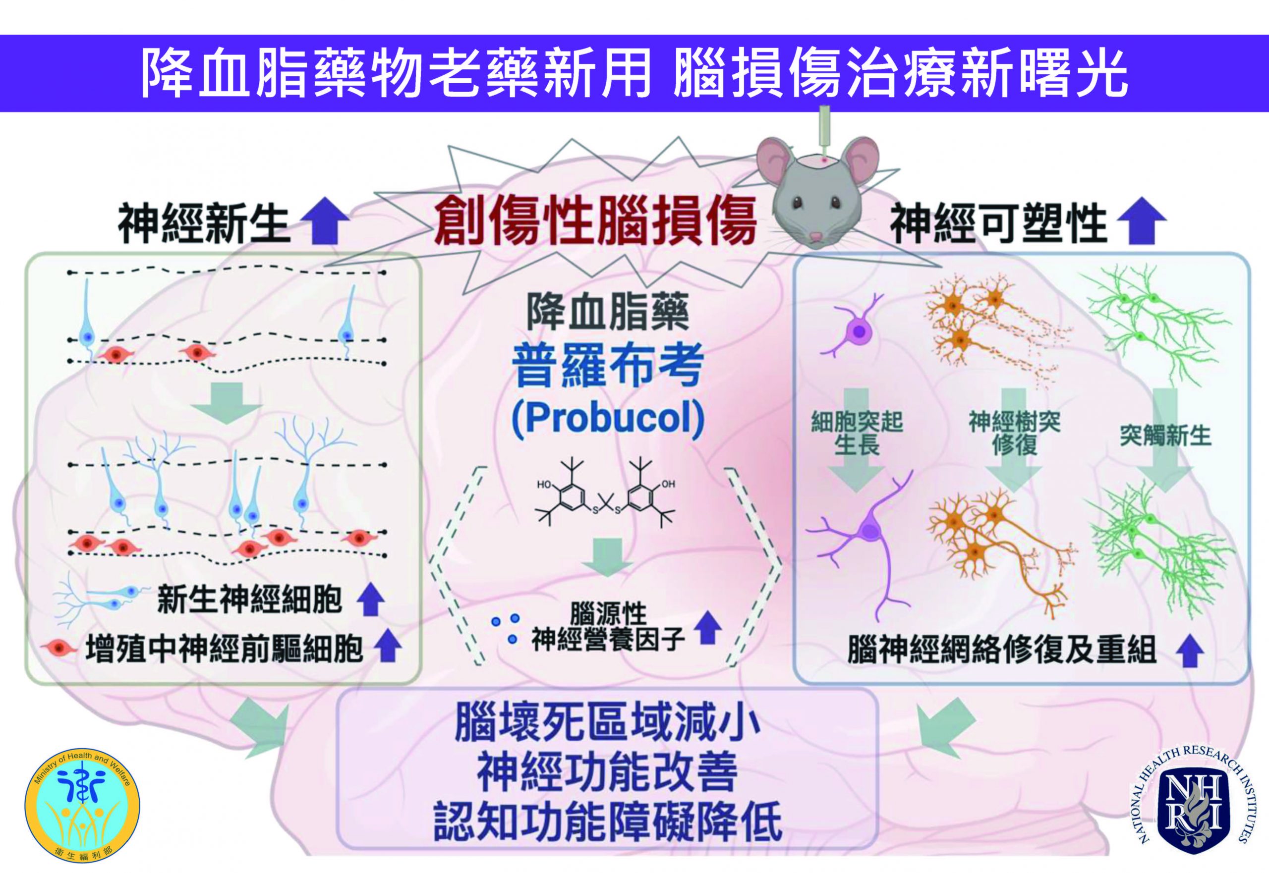 降血脂藥物老藥新用 腦損傷治療新曙光